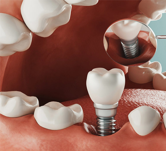 Dental Service Image