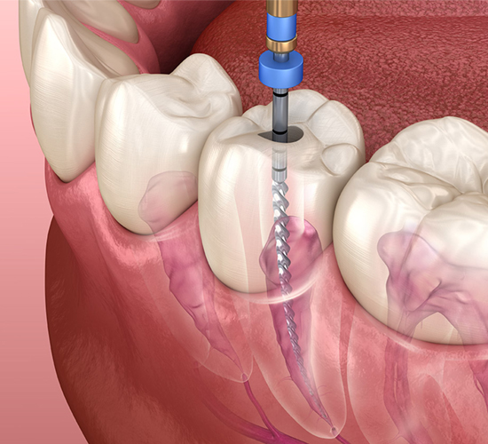 Dental Service Image